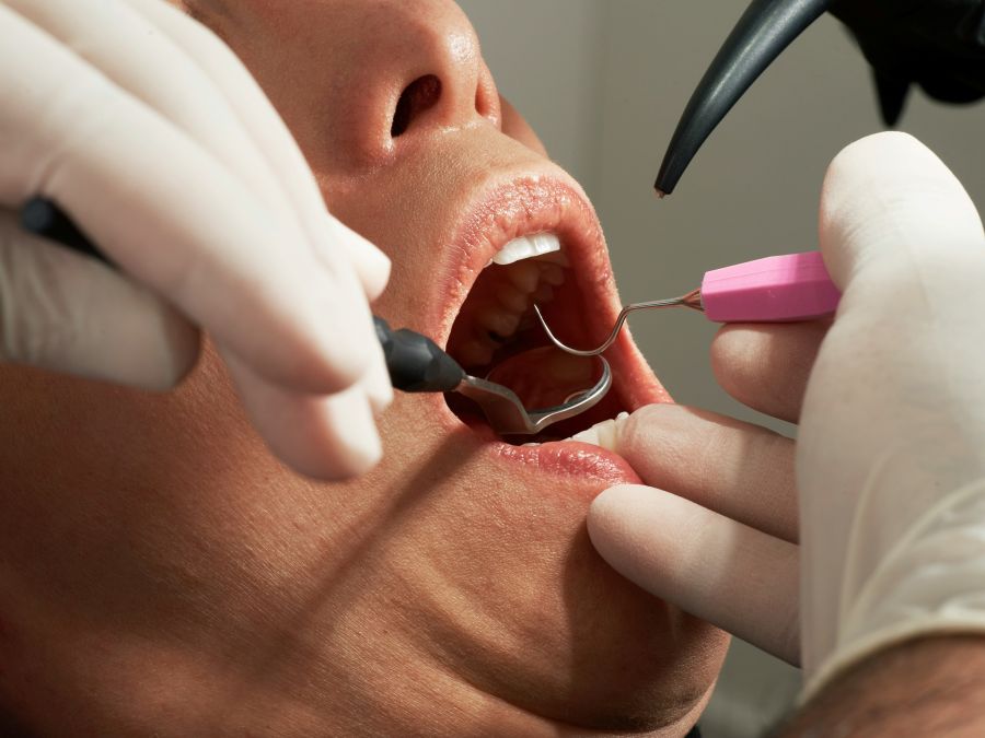 bucodental